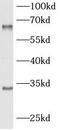 Hepatitis A Virus Cellular Receptor 2 antibody, FNab10125, FineTest, Western Blot image 