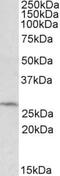 Defective In Cullin Neddylation 1 Domain Containing 1 antibody, PA5-19284, Invitrogen Antibodies, Western Blot image 