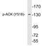 ACK1 antibody, LS-C291479, Lifespan Biosciences, Western Blot image 