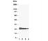 Growth Hormone 1 antibody, R30125, NSJ Bioreagents, Western Blot image 