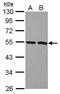 Peptidase Inhibitor 16 antibody, GTX121555, GeneTex, Western Blot image 
