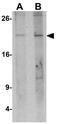 Triggering Receptor Expressed On Myeloid Cells 1 antibody, GTX31516, GeneTex, Western Blot image 