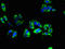 Transmembrane Protein 31 antibody, LS-C394848, Lifespan Biosciences, Immunofluorescence image 