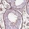Endoglin antibody, NBP2-49516, Novus Biologicals, Immunohistochemistry paraffin image 
