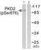 Protein Kinase D2 antibody, PA5-38421, Invitrogen Antibodies, Western Blot image 