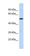 PR/SET Domain 11 antibody, orb324560, Biorbyt, Western Blot image 