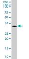 Calcium Voltage-Gated Channel Auxiliary Subunit Gamma 1 antibody, H00000786-B01P, Novus Biologicals, Western Blot image 