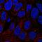 Tetratricopeptide Repeat Domain 6 antibody, HPA069293, Atlas Antibodies, Immunocytochemistry image 