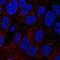 Tetratricopeptide Repeat Domain 6 antibody, HPA069293, Atlas Antibodies, Immunocytochemistry image 