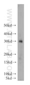 Insulin antibody, 15848-1-AP, Proteintech Group, Western Blot image 