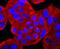 ATPase Sarcoplasmic/Endoplasmic Reticulum Ca2+ Transporting 2 antibody, A01176-1, Boster Biological Technology, Immunocytochemistry image 