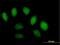 Scm Like With Four Mbt Domains 1 antibody, H00051460-B01P, Novus Biologicals, Immunofluorescence image 
