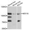 Mov10 RISC Complex RNA Helicase antibody, MBS128988, MyBioSource, Western Blot image 