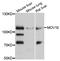 Putative helicase MOV-10 antibody, MBS128988, MyBioSource, Western Blot image 