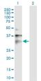 Chloride Intracellular Channel 1 antibody, H00001192-B01P, Novus Biologicals, Western Blot image 