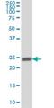 RAB5A, Member RAS Oncogene Family antibody, H00005868-M09A, Novus Biologicals, Western Blot image 