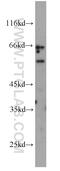 Lymphocyte Activating 3 antibody, 16616-1-AP, Proteintech Group, Western Blot image 