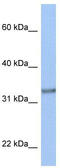 Acyl-CoA Binding Domain Containing 4 antibody, TA338670, Origene, Western Blot image 