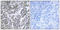 ATP Synthase F1 Subunit Delta antibody, LS-C119750, Lifespan Biosciences, Immunohistochemistry paraffin image 