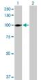 Integrin Subunit Beta 6 antibody, H00003694-D01P, Novus Biologicals, Western Blot image 