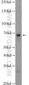 Histone Deacetylase 10 antibody, 24913-1-AP, Proteintech Group, Western Blot image 