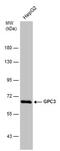 Glypican 3 antibody, PA5-77986, Invitrogen Antibodies, Western Blot image 