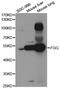 Fibrinogen Gamma Chain antibody, MBS2517618, MyBioSource, Western Blot image 