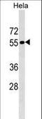 Tigger Transposable Element Derived 1 antibody, LS-C157195, Lifespan Biosciences, Western Blot image 