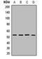 Solute Carrier Family 25 Member 24 antibody, LS-C668547, Lifespan Biosciences, Western Blot image 