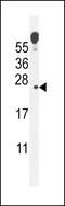 VOPP1 WW Domain Binding Protein antibody, LS-C167615, Lifespan Biosciences, Western Blot image 