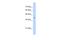 ST6 N-Acetylgalactosaminide Alpha-2,6-Sialyltransferase 6 antibody, A13165, Boster Biological Technology, Western Blot image 