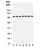 Succinate Dehydrogenase Complex Flavoprotein Subunit A antibody, R32062, NSJ Bioreagents, Western Blot image 