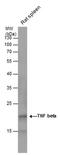 Lymphotoxin Alpha antibody, PA5-78046, Invitrogen Antibodies, Western Blot image 