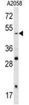 SRY-Box 4 antibody, GTX82513, GeneTex, Western Blot image 