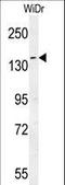 Dishevelled Associated Activator Of Morphogenesis 1 antibody, LS-C167258, Lifespan Biosciences, Western Blot image 