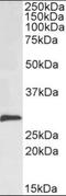 Snail Family Transcriptional Repressor 1 antibody, NB100-53787, Novus Biologicals, Western Blot image 