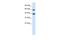 TRIM31 antibody, A10425, Boster Biological Technology, Western Blot image 