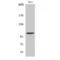 Eukaryotic Elongation Factor 2 Kinase antibody, LS-C383266, Lifespan Biosciences, Western Blot image 