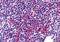 Zinc Finger Protein 687 antibody, GTX31993, GeneTex, Immunohistochemistry paraffin image 
