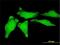 Y-Box Binding Protein 1 antibody, H00004904-M02, Novus Biologicals, Immunocytochemistry image 