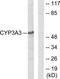 Cytochrome P450 Family 3 Subfamily A Member 4 antibody, TA313729, Origene, Western Blot image 