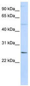 Ferritin Heavy Chain Like 17 antibody, TA339588, Origene, Western Blot image 