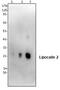 Lipocalin 2 antibody, GTX59781, GeneTex, Western Blot image 