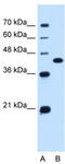 Urea transporter 1 antibody, TA346523, Origene, Western Blot image 