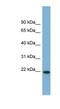 Fibronectin Type III Domain Containing 4 antibody, NBP1-59690, Novus Biologicals, Western Blot image 