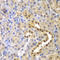 Glyoxalase I antibody, LS-C331773, Lifespan Biosciences, Immunohistochemistry paraffin image 