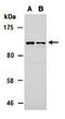 Protein Tyrosine Phosphatase Non-Receptor Type 22 antibody, orb67293, Biorbyt, Western Blot image 
