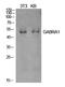 Gamma-Aminobutyric Acid Type A Receptor Alpha1 Subunit antibody, STJ97264, St John