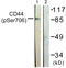 CD44 antibody, LS-C198764, Lifespan Biosciences, Western Blot image 