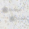 Cysteine Rich Hydrophobic Domain 2 antibody, A7971, ABclonal Technology, Immunohistochemistry paraffin image 